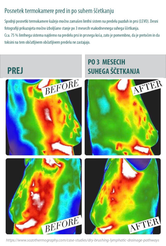 Termokamera